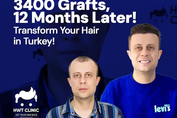 HWT Clinic - Hair Transplant Turkey - Saç Transplantasyonu Kliniği - İstanbul Kartal