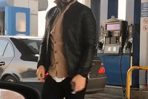 Egemen Güdül Hair Clinic Ankara Saç Ekim Merkezi Ankara - Saç Transplantasyonu Kliniği - Ankara Akyurt