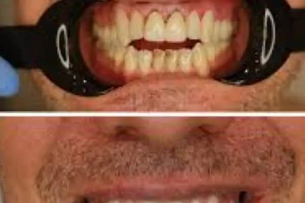 Dentporte Ağız ve Diş Sağlığı Polikliniği - Diş Kliniği - Ankara Etimesgut