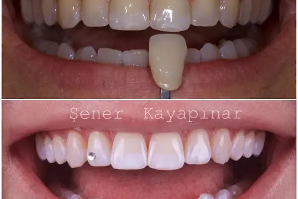 Dr. Şener KAYAPINAR Diş Kliniği - Diş Hekimi - Diyarbakır Kayapınar