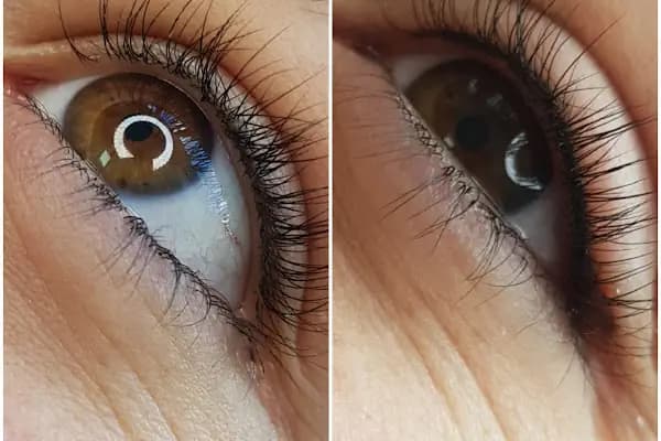 Henna Güzellik Salonu - Lazer Epilasyon Hizmeti - Gaziantep Nizip