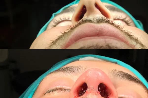 Op. Dr. Ahmet Akatekin Muayenehanesi - Konya Burun Estetiği, Estetik Cerrah Konya - Estetik Cerrahi Kliniği - Konya Akören