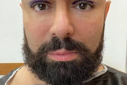 Op. Dr. Fatih Burak Efeoğlu
