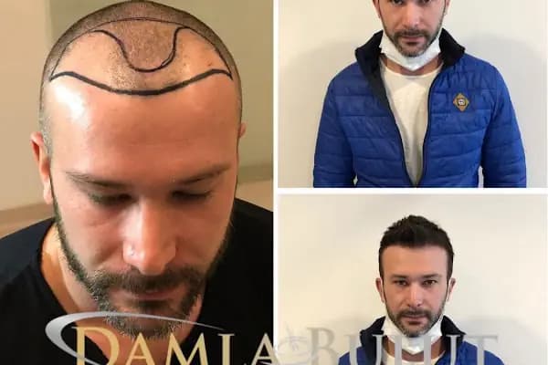 Damlabuluthairtrans Saç Ekim Kliniği - Kurumsal Ofis - İstanbul Arnavutköy
