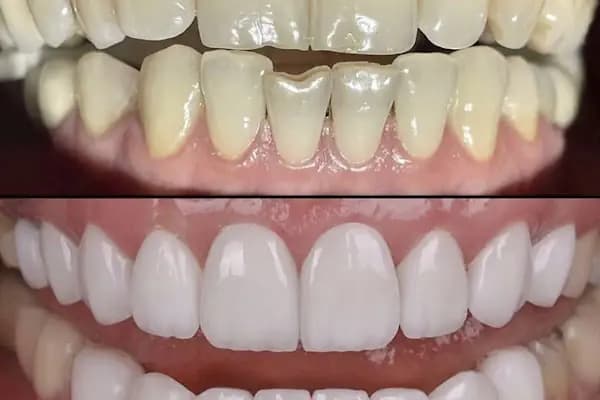Dr.WONDER CLİNİC - Diş Kliniği - İstanbul Bağcılar