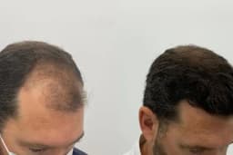 Allina Hair Clinic / Saç Ekimi ve Saç Sorunları Merkezi