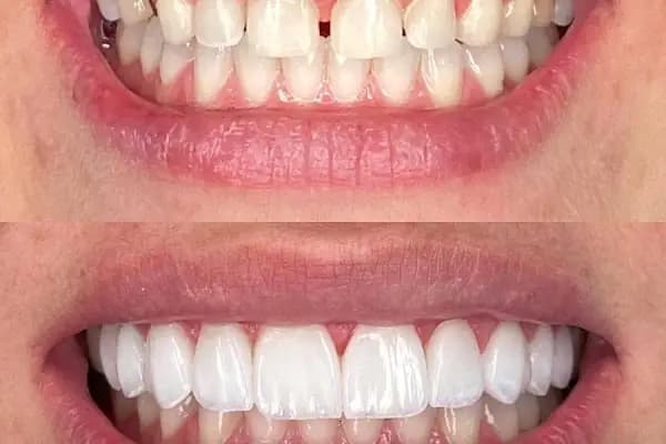 Arzu Sarıyıldız Turgutreis Bodrum Diş Kliniği | İmplant ve Dental Estetik Diş Kliniği - Diş Kliniği - Muğla Bodrum