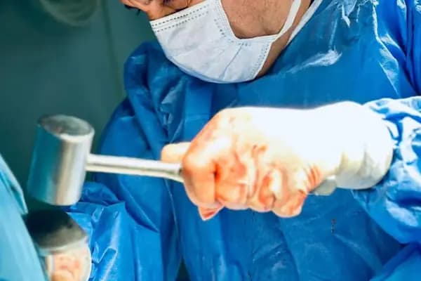 Prof. Dr. Mustafa Özkan , Ortopedi ve Travmatoloji , Üst Ekstremite ve El Mikrocerrahisi - Ortopedi Cerrahı - İzmir Konak