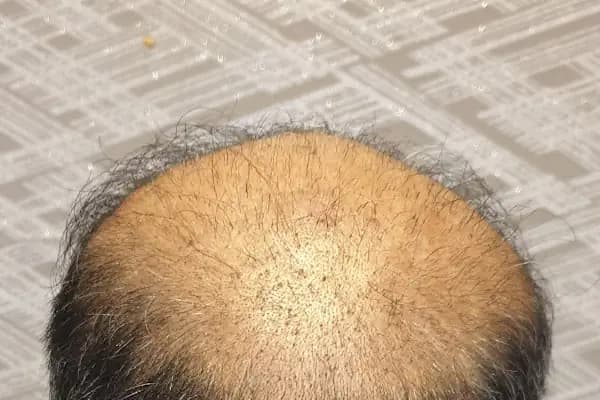 Clinicexpert - Estetik Cerrahi Kliniği - İstanbul Bahçelievler