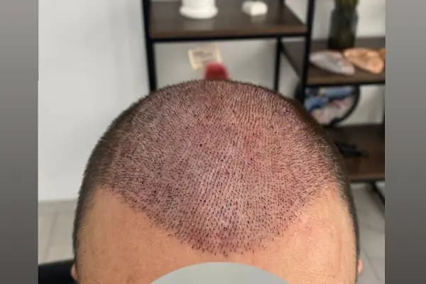 Songül Aktaş Hair &amp; Beauty Center - Sağlık ve Güzellik Merkezi - Muğla Menteşe