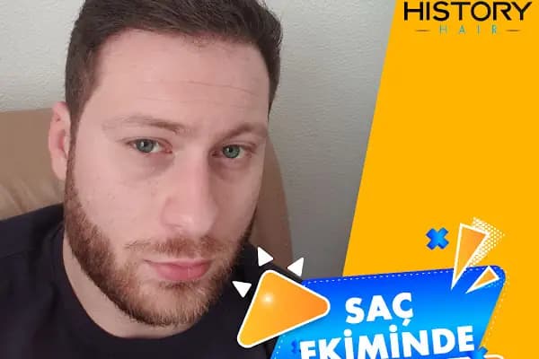 Özel History Clinic Polikliniği | Hair Transplant Clinic in Turkey - Saç Transplantasyonu Kliniği - İstanbul Ataşehir