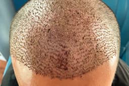 Hollywood Hair Center