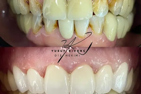 Özel Smile Center Van Ağız ve Diş sağlığı polikliniği - Diş Kliniği - Van İpekyolu