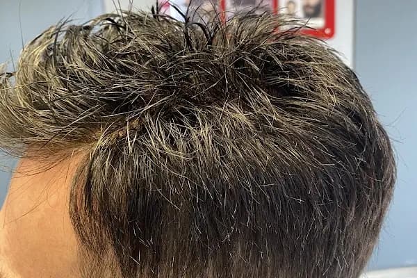 Protez Saç Ankara (Hairlife) - Kuaför - Ankara Mamak