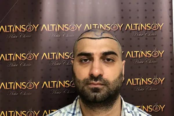 Van Saç Ekim Merkezi / Van Saç Ekimi / Altınsoy Hair Clinic - Saç Transplantasyonu Kliniği - Van İpekyolu