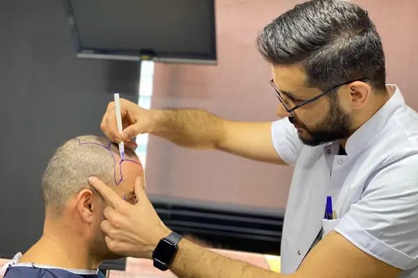 Master Hair Transplant - Hastane Birimi - İstanbul Esenyurt