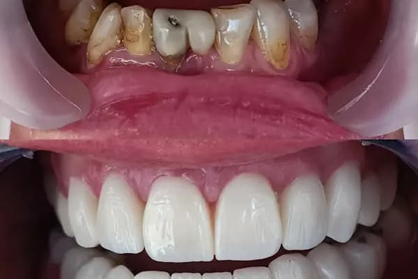 Diş hekimi Mehmet ÖZER-Alanya Diş hekimi -Diş kliniği-İmplant -Zirkonyum-Acil Diş-Kanal Tedavisi-Porselen kaplama-Dentist- - Diş Kliniği - Antalya Demre