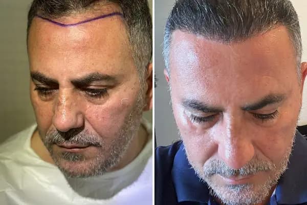 Clean Hair Diyarbakır - Sağlık Danışmanı - Diyarbakır Çermik