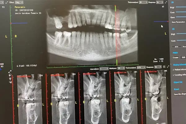 DİŞ HEKİMİ MÜGE AKTAŞ GÜLTEKIN- DİŞ HEKİMİ ATAMAN ÖZGEN GÜLTEKİN - Diş Kliniği - İzmir Balçova