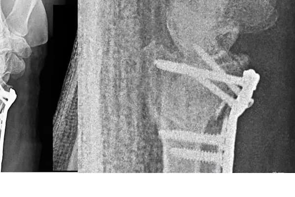 Operatör Doktor Tarık Alphan Ortopedi ve Travmatoloji - Ortopedi Kliniği - İzmir Bergama