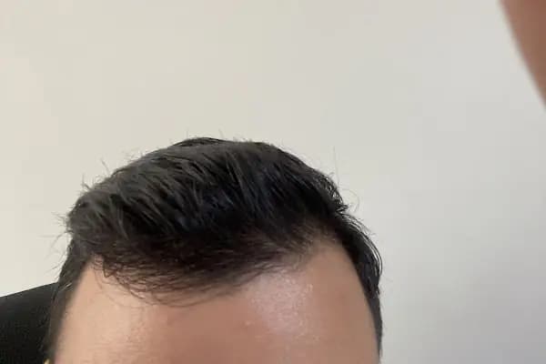 Data Hair Clinic &amp; Eyyüp Tütüncü Saç Ekim Merkezi - Saç Transplantasyonu Kliniği - İstanbul Beylikdüzü