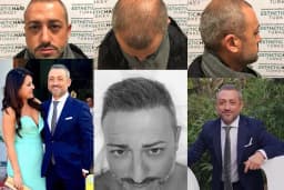 Esthetic Hair Turkey