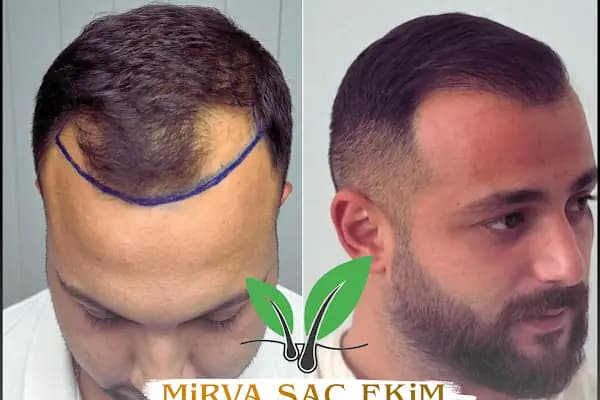 Hifa'M Beauty Center - Güzellik Salonu - Şanlıurfa Birecik