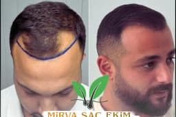 Hifa'M Beauty Center
