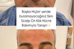 S Clinic Adana - Saç Çoğaltma, Saç Bakım ve Güzellik Merkezi