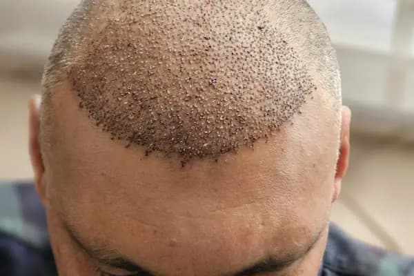 Alanya Estetik Op. Dr. Selahaddin ASLAN - Estetik Cerrahi Kliniği - Antalya Alanya