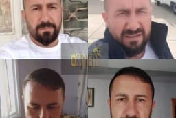 Özmen Saç Ekim , Estetik Ve Güzellik Merkezi