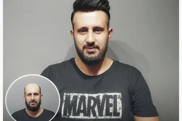 Magic Hair Protez Saç Merkezi - Saç Yenileme Hizmeti - İstanbul Maltepe
