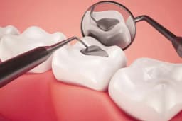 Barla Dent Ağız Diş Sağlığı