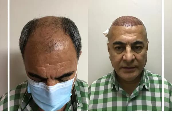 Estetik &amp; güzellik Şanliurfa Saç Ekim Merkezi /زراعة الشعر في أورفا - Sağlık ve Güzellik Merkezi - Gaziantep Nizip