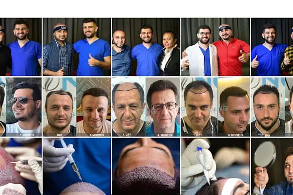 Long Hair Center Istanbul (LHC CLINIC) - Saç Transplantasyonu Kliniği - İstanbul Bahçelievler
