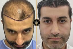 Real Of Hair - Hair Transplant Center in Turkey