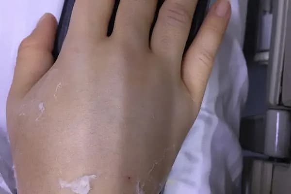 Doç. Dr. Semih Akkaya - Ortopedi Cerrahı - Denizli Merkezefendi