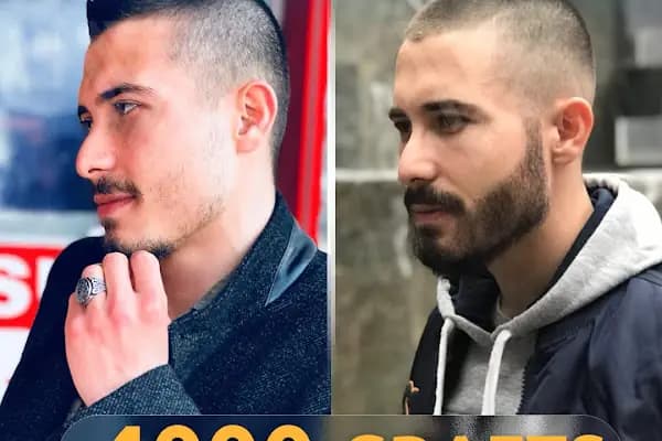 VEYSİ KAPLAN SAÇ EKİMİ &amp; ESTETİK - Saç Yenileme Hizmeti - İstanbul Şişli