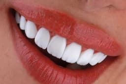 Estetik Bodrum | Dudak Dolgusu | Botoks | PRP | Mezoterapi | İp Askı | Cilt Bakımı | Gençlik Aşısı