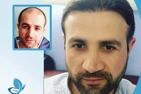 Essença CLINIC - Saç Transplantasyonu Kliniği - İstanbul Ataşehir