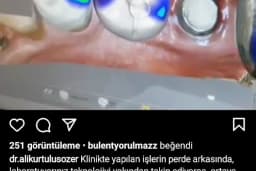 Asdent Ağız Ve Diş Sağlığı Polikliniği