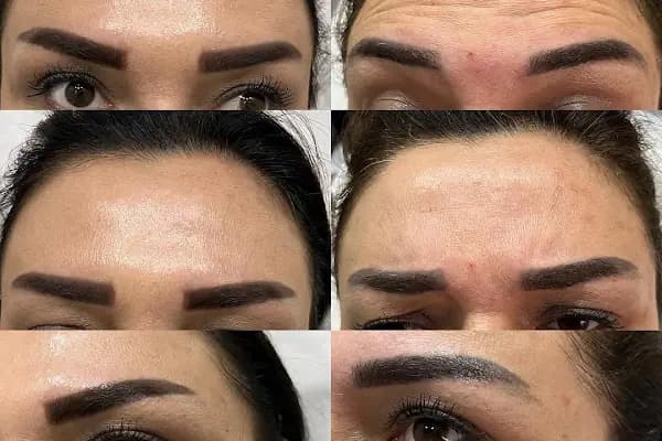 Aura Bella Klinik ve Güzellik Gaziantep - Güzellik Salonu - Gaziantep Şehitkamil