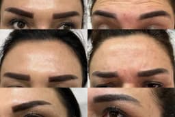 Aura Bella Klinik ve Güzellik Gaziantep