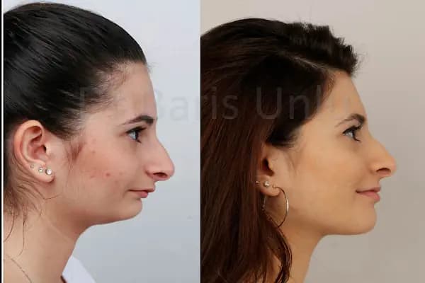 Ortodontist Diş Kliniği - Diş Kliniği - İstanbul Şile