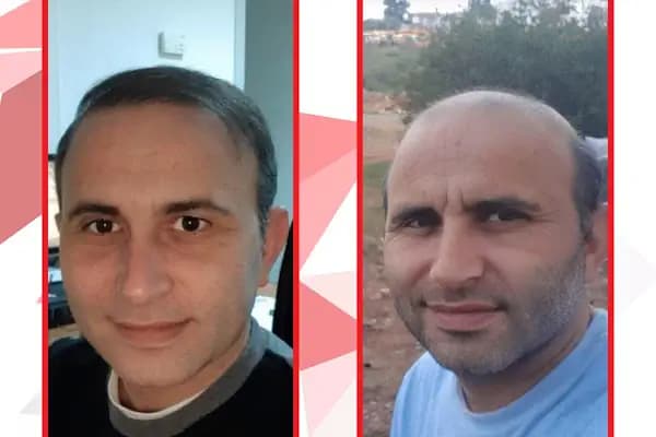 Anatolia Saç Ekim - Saç Transplantasyonu Kliniği - İstanbul Tuzla