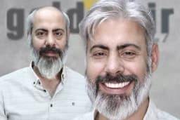 Gold Hair İstanbul - Protez Saç ve Gerçek Saç Merkezi | Real Hair Replacement Center