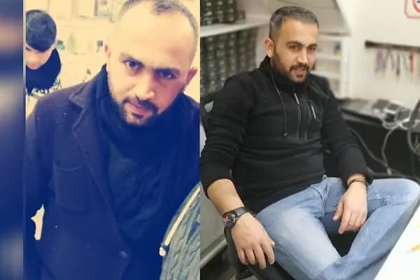 History Clinic (History Hair - History Dent) - Saç Transplantasyonu Kliniği - İstanbul Ataşehir