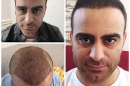 Serap Lazer Epilasyon &amp; Güzellik Salonu Birecik