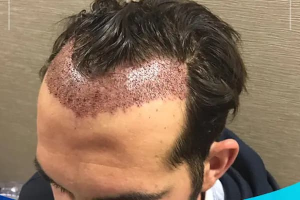 Este Çapa - Estetik Cerrahi Kliniği - İstanbul Fatih