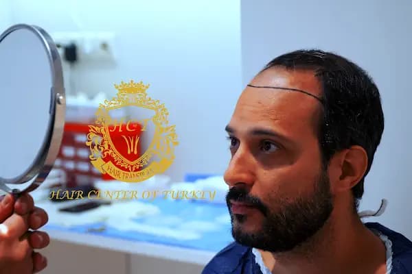 Hair Center of Turkey - Saç Ekimi, Sakal ve Kaş Ekimi Merkezi | Hair Center - Saç Transplantasyonu Kliniği - İstanbul Ümraniye